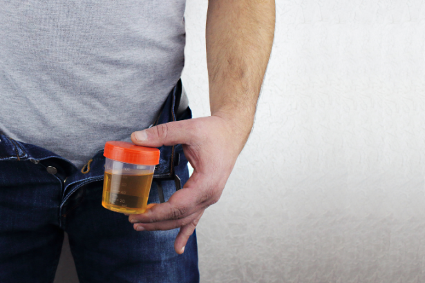 Lawrence Aseba Tipo explica o que a urina com espuma pode indicar e quando é hora de procurar atendimento médico.